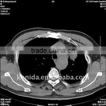 Women hot sex images, x-ray medical thermal films compatible with fuji cr,diagnostic x-ray equipment