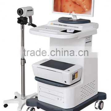 Full hd vagina colposcope for sony 1300000 pixels camara