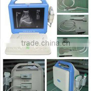 2016 LCD Display Ultrasound Scanner With Convex Probe photo-4
