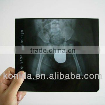 medical laser printing film,medical produce,medical ray tube