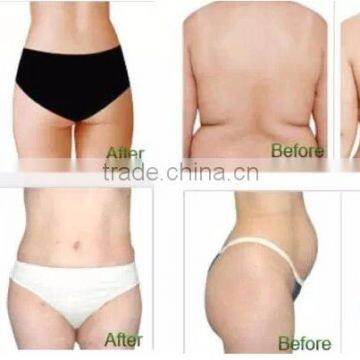 Most Professional Device CE Approved Coolplas Cryolipolisis Fat Freeze Slimming Machine