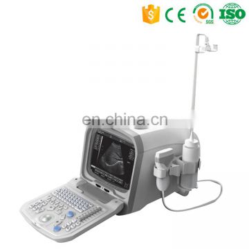 Cheapest Clinic 2d diagnostic ultrasonic gel machine ultrasound portable for human