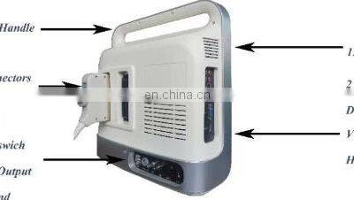 Hot Selling Medical Cheapest-portable-ultrasound-machine for Hospital and Clinic Use photo-2