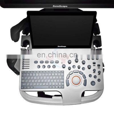 Factory Price Trolley Color Ultrasound Scanner/Sonoscape P50/portable Color Doppler Ultrasound/Color Doppler Ultrasound Machine