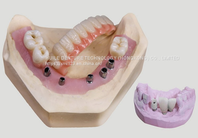 Elite Occlusal Night Guard China Outsourcing Dental Lab photo-5