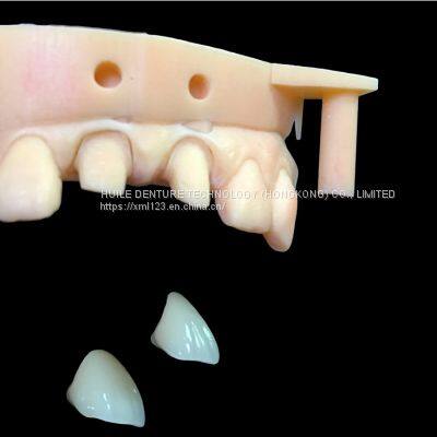 Digital-Crowns-Bridges Chinese Dental Lab Denture photo-5