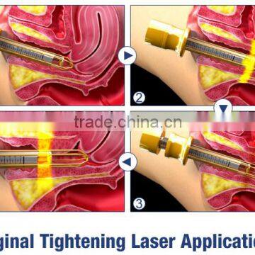 Skin Whitening MSLCF02A Factory Direct Best Price Fractional Co2 Wart Removal Laser Equipment Co2 Laser Scar Removal Face Whitening Vascular Lesions Removal photo-3