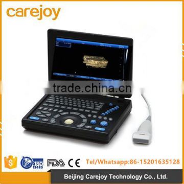 laptop ultrasound scanner with 3D function