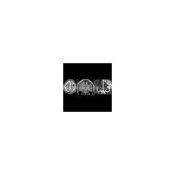 medical dry film,x-ray film,CT film