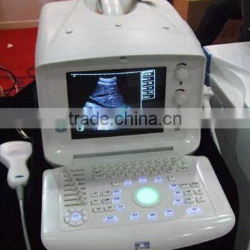 2016 Portable Ultrasound Scanner with Convex Probe