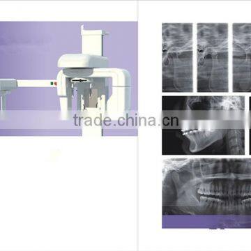 Intraoral digital x-ray- Dental Imaging