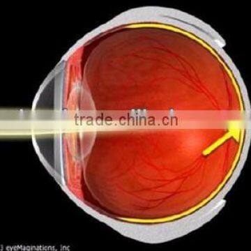 China Contact lens for amblyopic treatment, Effective treatment myopic eyes