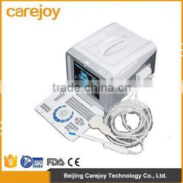 Good price Portable Ultrasound Scanner Ultrasonic Diagnostic Machine with 3.5MHz Convex Probe 10 inch monitor