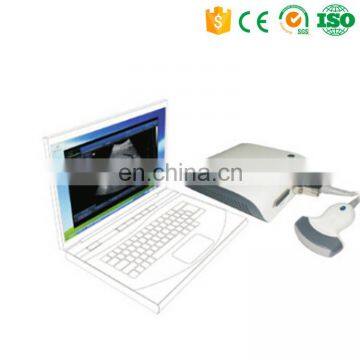 MY-A010 USB Ultrasound Probe Price Ultrasound B Scanner Box with 3D Imaging