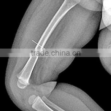 medical thermal x ray film,medical consumable item ,medical surgical consumables