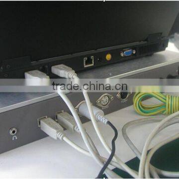 Professional EMG EP Systems Electromyography Myoelectricity Connecting Computer for Neurology With CE ISO photo-3