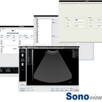 Top Quality 3D B/W Doppler Sonoview Machine Trolley Ultrasound Scanner photo-3