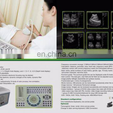 MY-A001A Laptop Full Digital Portable Ultrasound Scanner Mini Ultrasound Machine photo-2