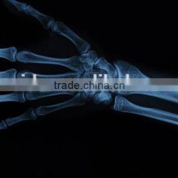 Konida Medical Dry Film, x ray film made in China, compatible with agfa and fuji