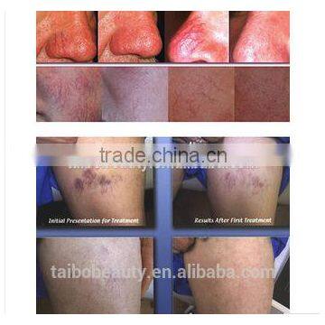 Last Price Portable Spider Vein Red Blood Vessels Removal Machine photo-6