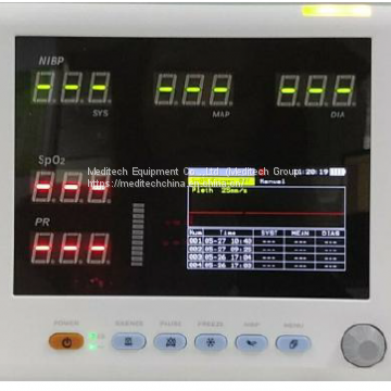 Oxima3 Vital Signs Monitor Three Parameters: NIBP SpO2 and Pulse Rate Ce Approved photo-4