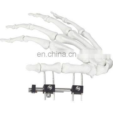 CE & ISO Marked Mini Fragment External Fixator (Finger and Palm) Surgical Instrument photo-4