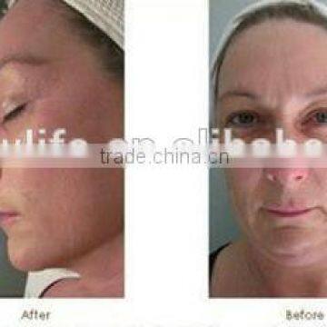 NL-RFC200 Portable Multi-functional RF/monopolar rf Skin Rejuvenation Machine /monopolar rf Skin Care Machine photo-6