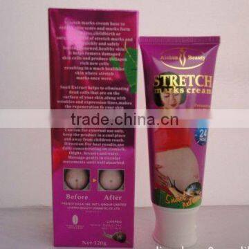 herbal stretch mark cream NEW