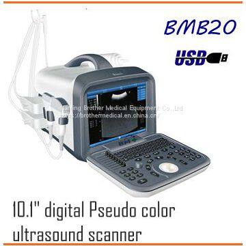 10.1 inch full digital Pseudo color ultrasound scanner