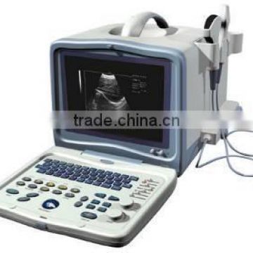 Full Digital Portable Ultrasound Scanner AJ-6116/ Convex / linear of electronics ( 128 elements)