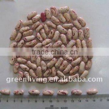 2011 light speckled kidney beans' price(from china)