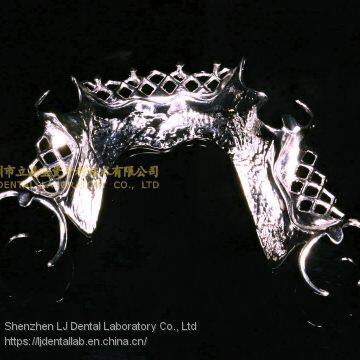 Dental Co-Cr Partial Denture,Titanium Framework Denture, Dental Dentures, Laboratoire Dentaire, Dentallabor, Laboratorio Dental, Dental Laboratory, Shenzhen LJ Dental Lab China photo-2