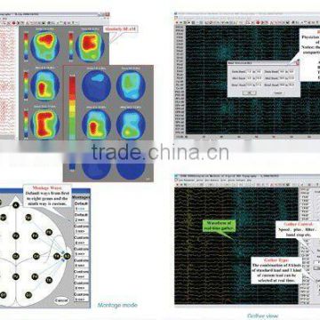 32 Channels Digital EEG System KT88-3200/ EEG portable EEG device