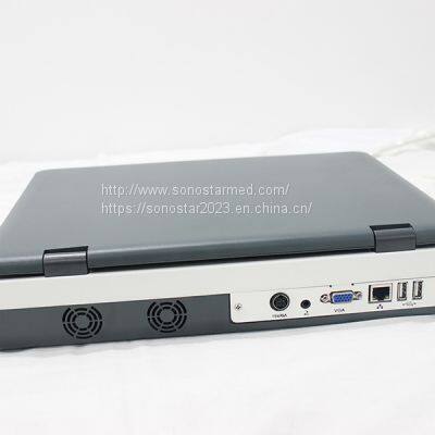 C5Mini Color Doppler Ultrasound System photo-2