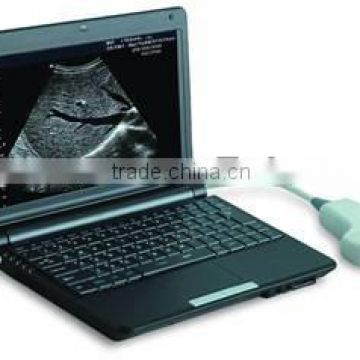 Full Digital Laptop Ultrasound Scanner AJ-6000Plus