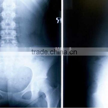 medical hot sex x-ray film,wholesale x-ray medical film