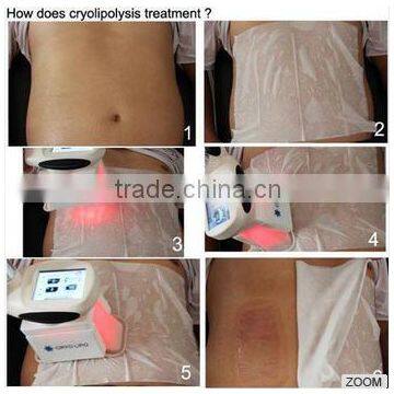 2016 Double Heads Portable Cryolipolysis Fat Freeze Weight Loss Zeltiq Burner Machine Beauty Spa Salon Equipment Supplier Weight Loss