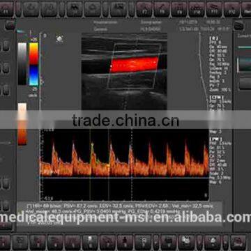 Coupon Available! Ipad Ultrasound Scanner, Touch Screen Scanner 3D Color Doppler MSLCU22-N