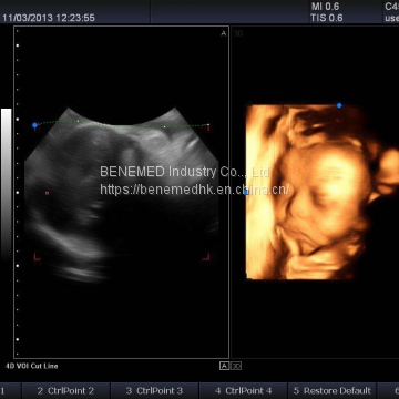 Премиумный 4D цветной допплеровский ультразвуковой сканер photo-2