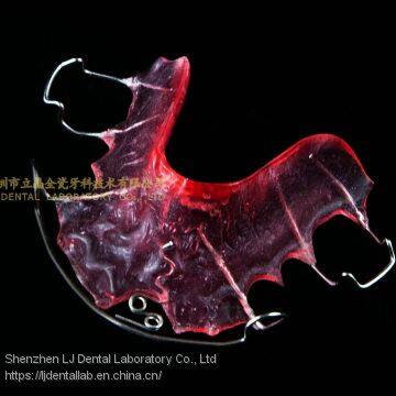Dental Orthodontic Appliance, Bionator Appliance, Frankel Appliances, Fan-type Expander, Laboratoire Dentaire, Dentallabor, Laboratorio Dental, Dental Laboratory, Shenzhen LJ Dental Lab China photo-2