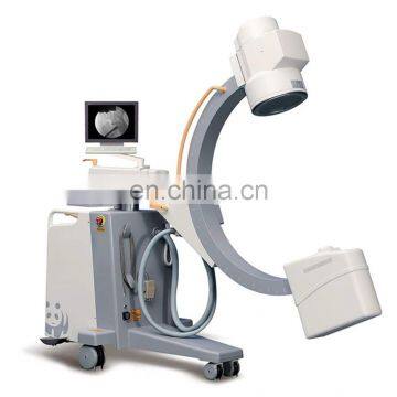 MY-D035B-N High frequency radiology equipment mobile digital photography c arm x-ray machine