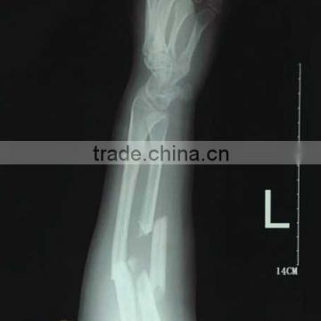 medical x-ray film agfa,x-ray blue film ,hot laminating film thermal laminating film xx