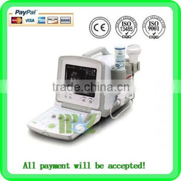 MSLPU12 ultrasound machine for pregnancy