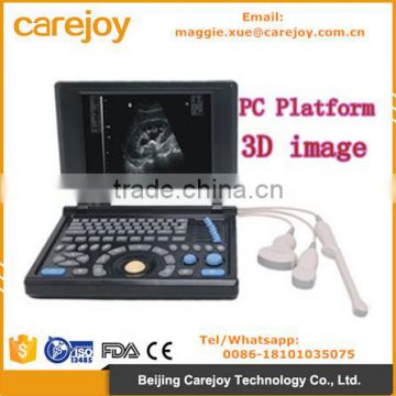 CE ISO certified Ultrasound machine / scanner diagnostic system with 3.5Mhz Convex probe