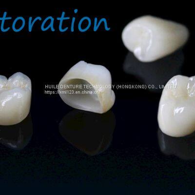 Flexible Partial Denture Zirconia Dental Crown