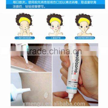 Nuobisong Best Pimples Removal Face Acne Treatment Cream Acne Skin Care 15g/piece