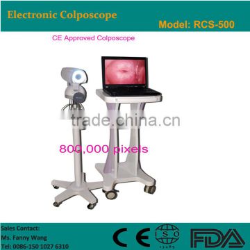 Digital High-Pixel Electronic Video Colposcope(RCS-500)