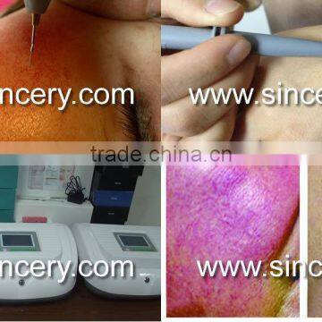Beauty Therapy System HF or RF Vascular Vein Removal Treatment Device photo-4