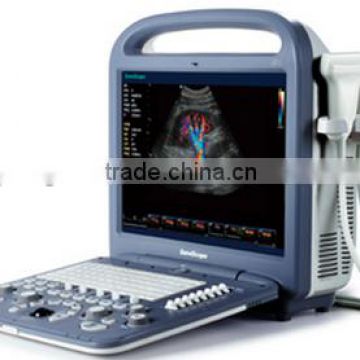 MC-DU-S2 Cheap 3D 4D Portable Color Doppler Ultrasound Scanner