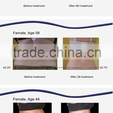 650nm Lipo Laser Weight Loss / Weight Loss Laser Machine / Lipo Laser Fat Reduction photo-4